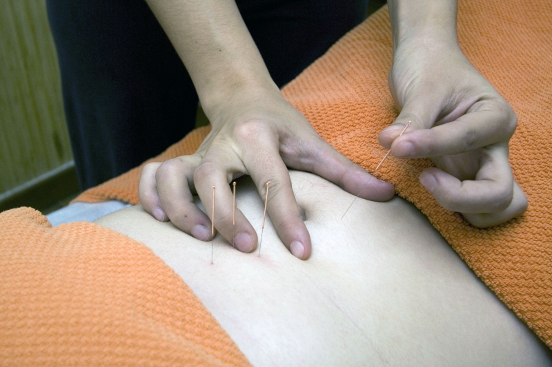 osteopathe-ESPARRON-min_acupuncture-4175625